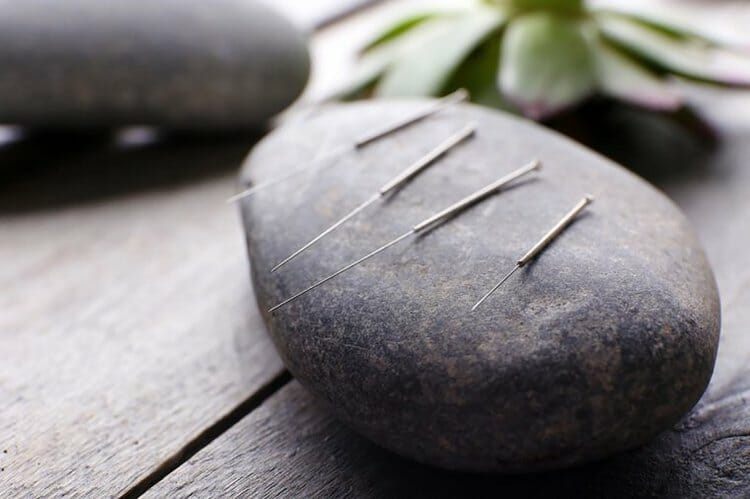 acupuncture for fertility and women's health